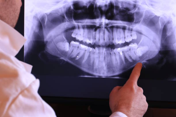 Best Emergency Dental Services for Seniors in Topeka, IN